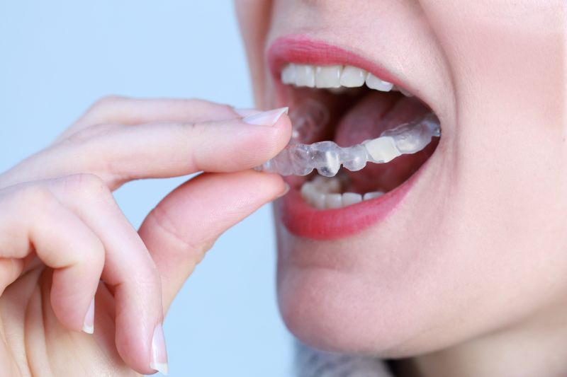 bite ma continui a serrare i denti